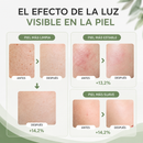 MÁSCARA FACIL LED